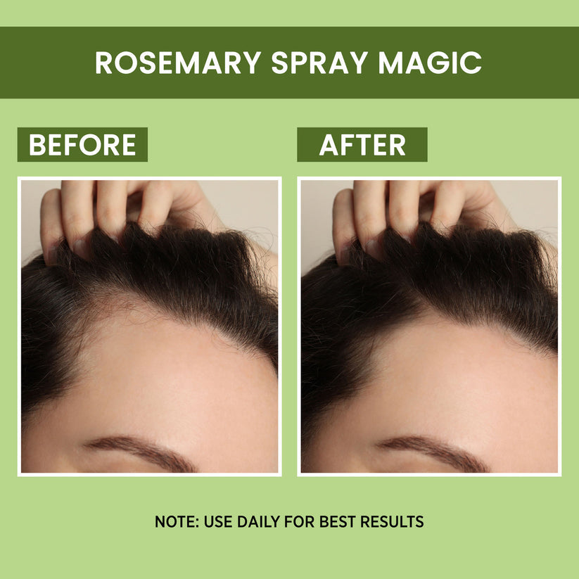Rosemary Water, Hair Spray For Regrowth (Buy 1 Get 1 Free) | 4.9 ⭐⭐⭐⭐⭐